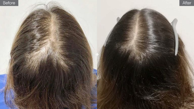 Grow Hair Oil