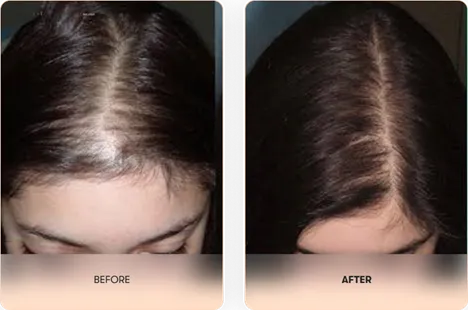 Grow Hair Oil