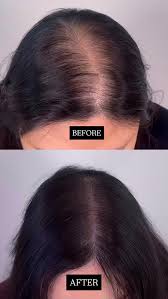 Grow Hair Oil